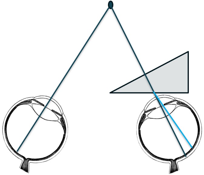 Deviation of rays toward base in Ophthalmic Prism