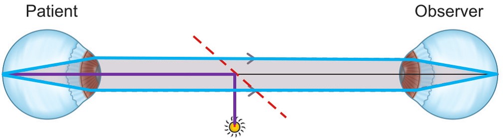 Principle of Direct Ophthalmoscope