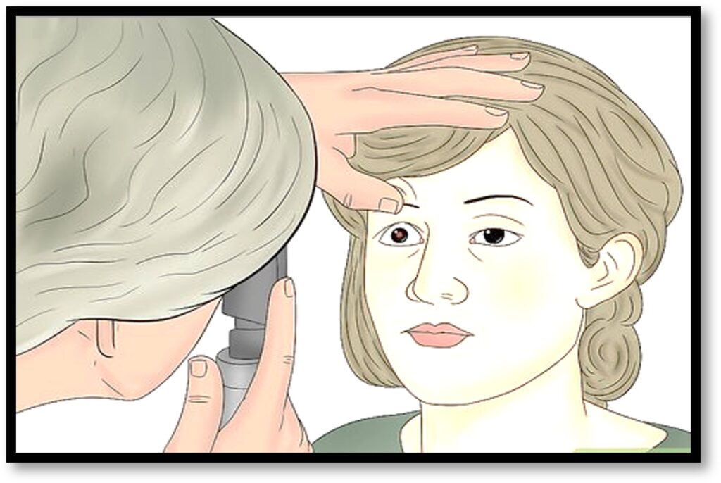 Procedure of of Direct Ophthalmoscopy