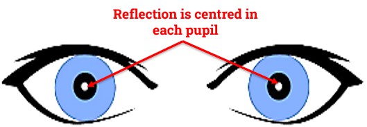 Central Corneal Reflex in Hirschberg Test