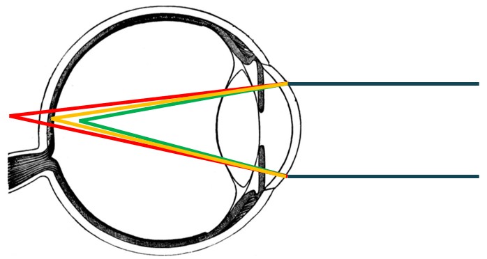 Chromatic Aberration and Duochrome Test