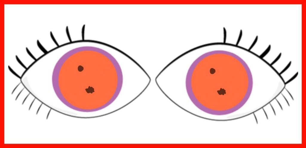 Media Opacities in Bruckner's Test