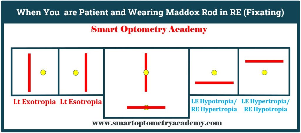 Interpretation Table of Maddox Rod Test