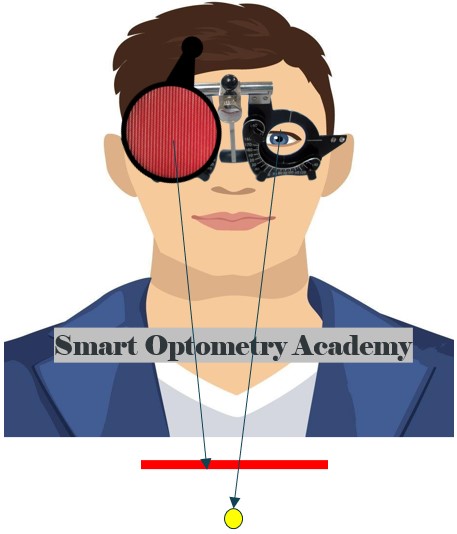 RE Hypotropia in Maddox Rod Test