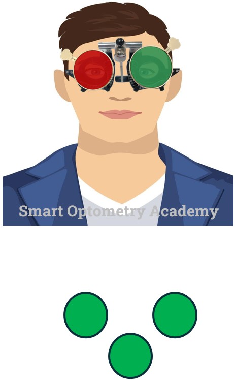 Right Eye Suppression in Worth 4 Dot Test