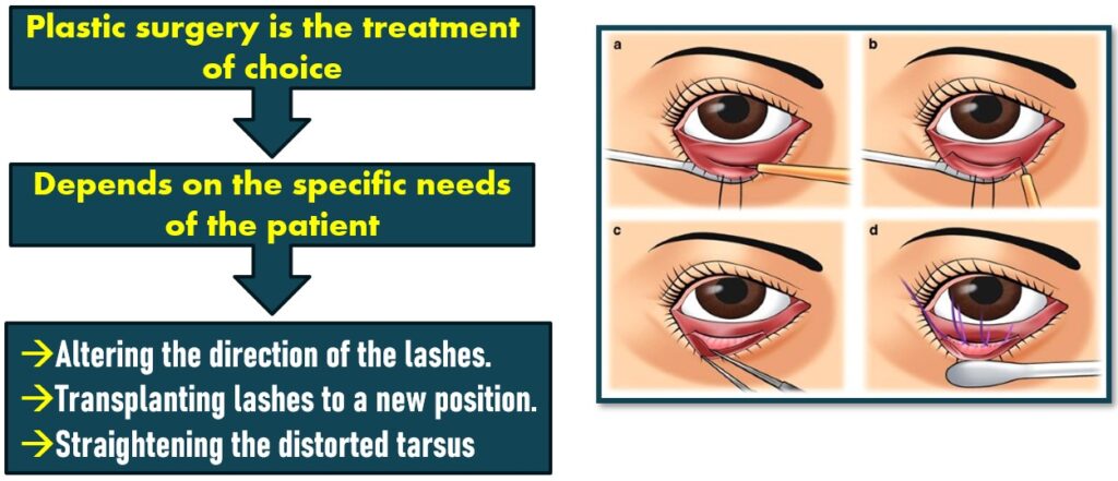 Treatment of Cicatricial Entropion