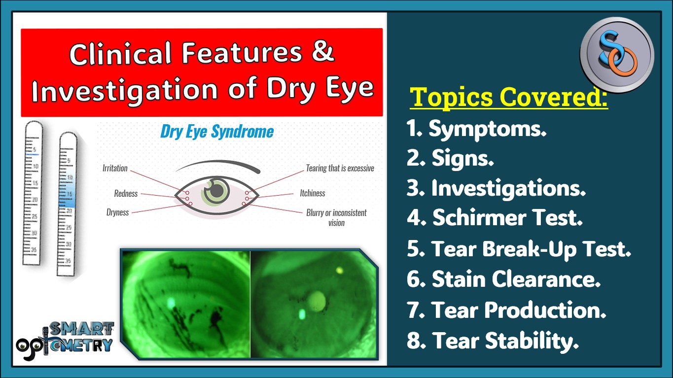 Clinical Features and Investigation of Dry Eye