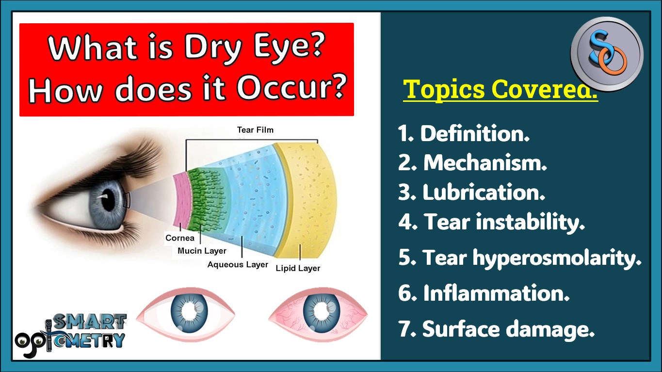 What is Dry Eye- How does Dry Eye Occur?