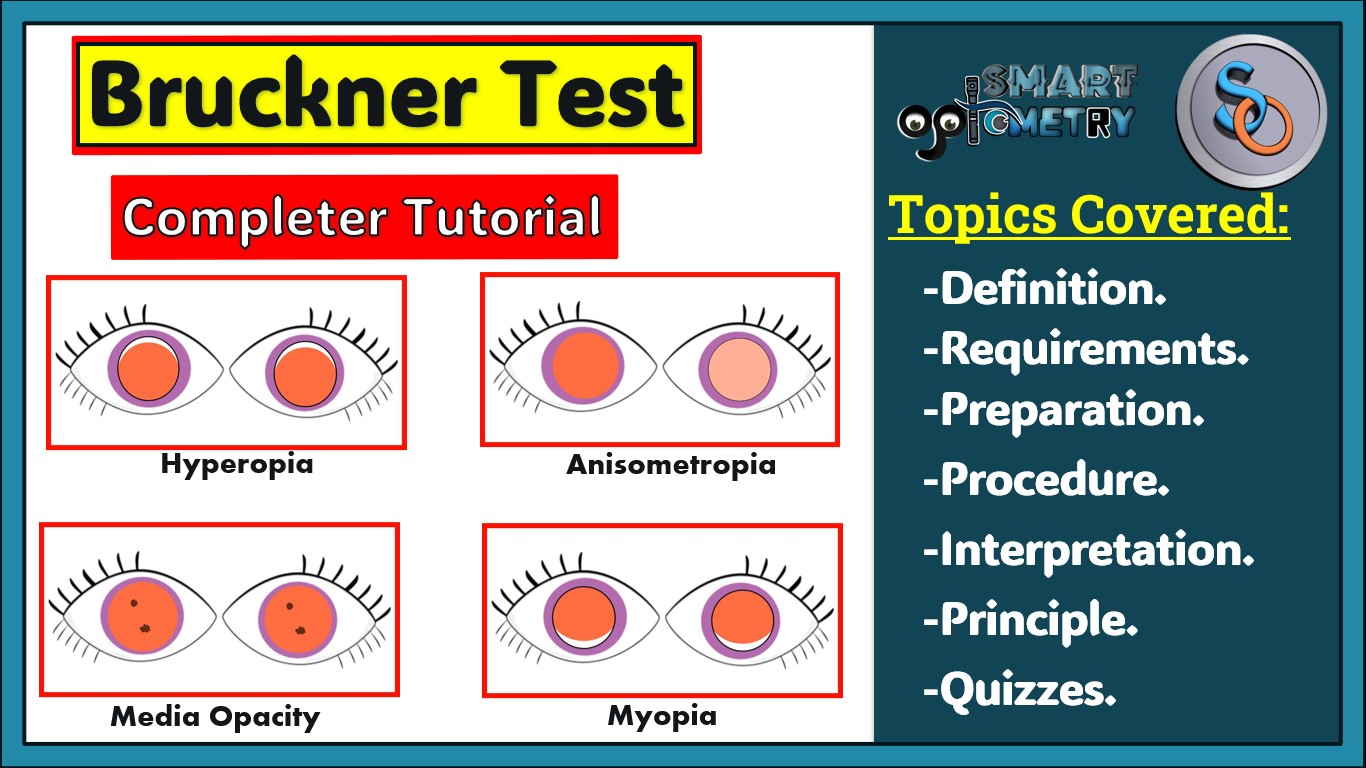 Blog- Buckner Test- Everything you need to know