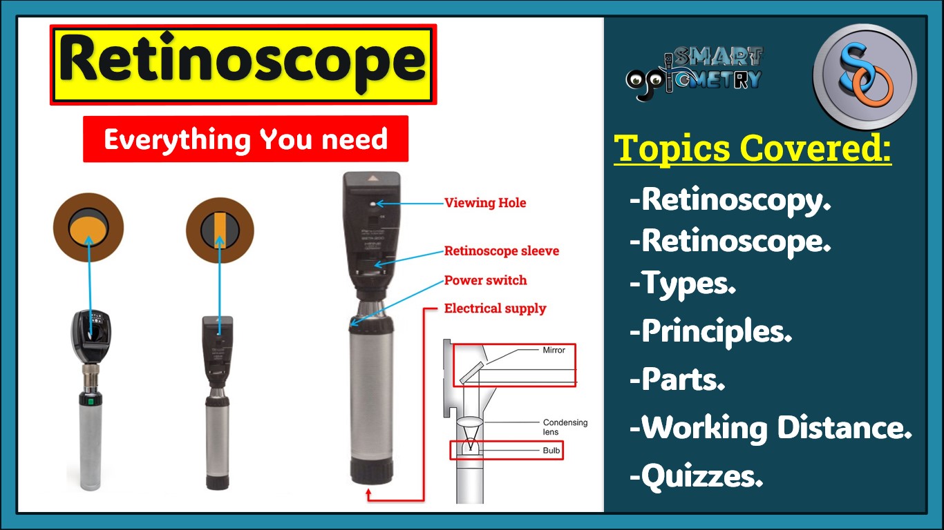 Retinoscopy/Refraction - Smart Optometry