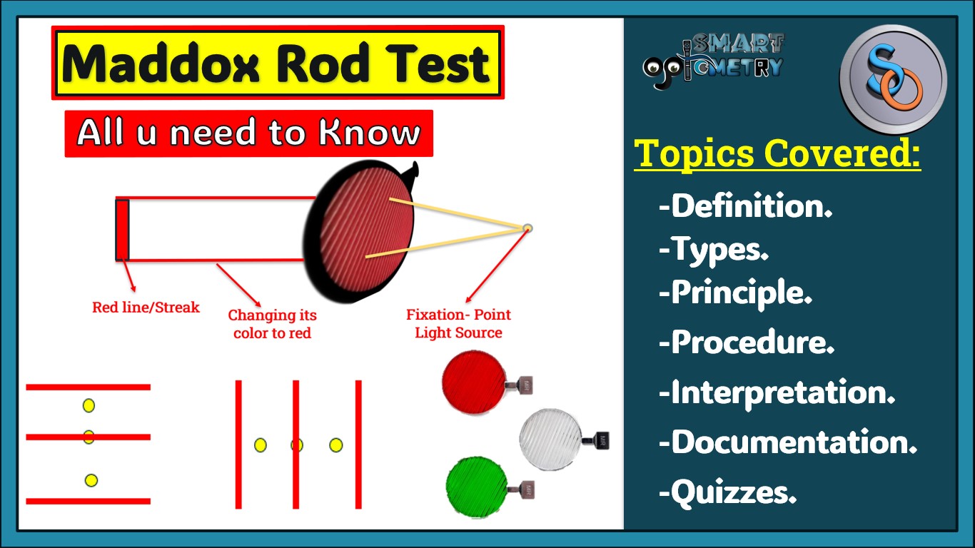 Maddox Rod Test- All you need to know