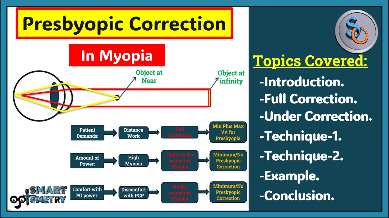 How to prescribe Presbyopic power in Myopia. - Smart Optometry