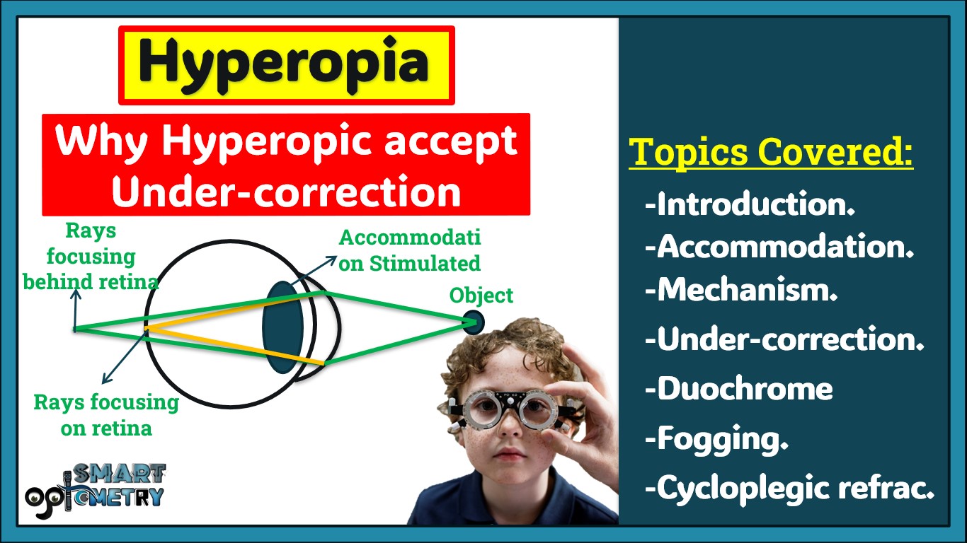 Hyperopia- Why Hyperopic Accepts Under correction during Refraction.