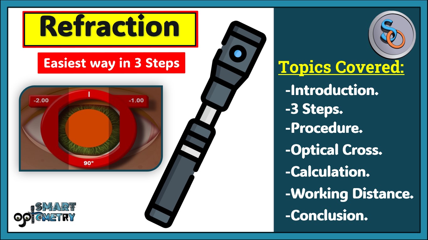 Retinoscopy in 3 Steps - Easiest way to do Refraction