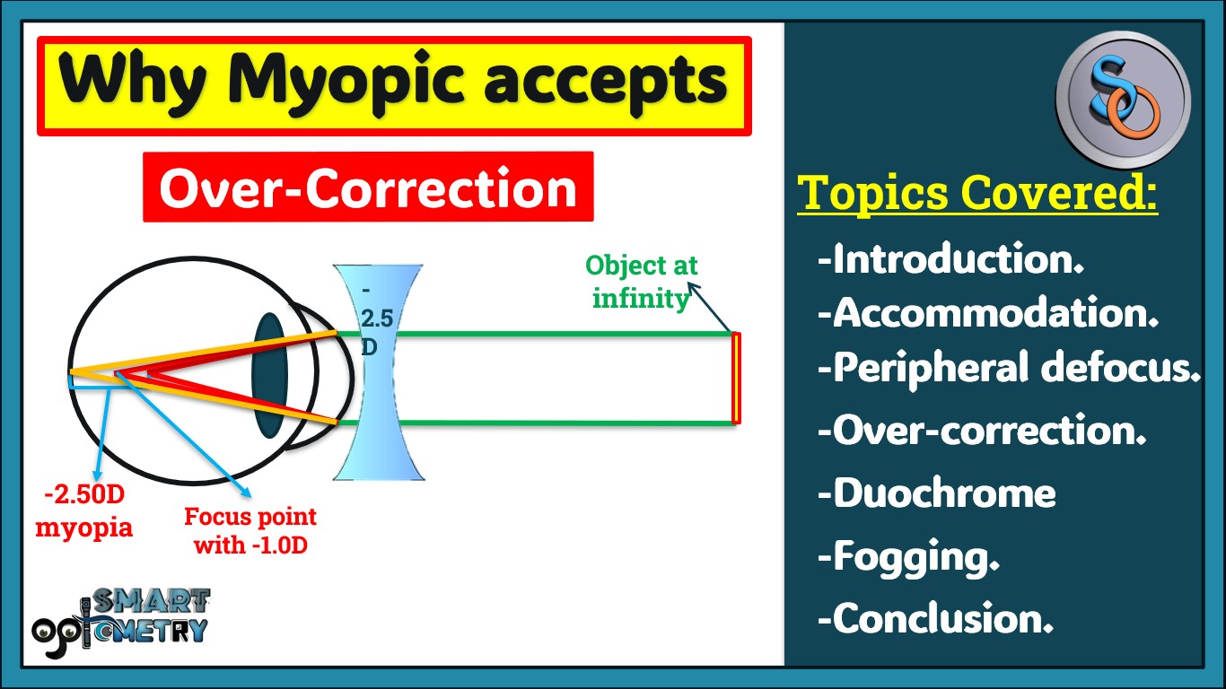 Myopia- Why Myopic accepts Over correction