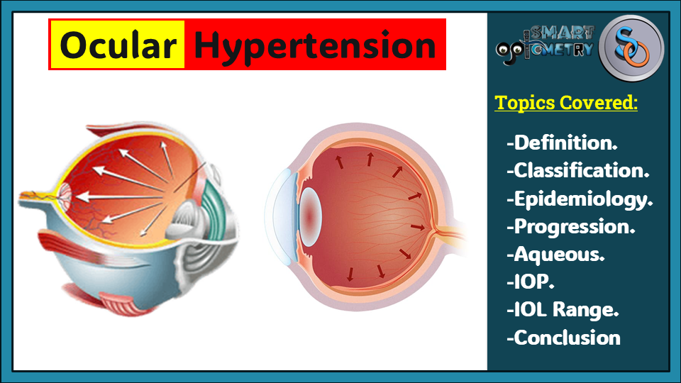 Ocular Hypertension- All you need to Know