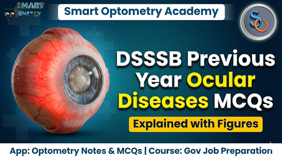 DSSSB Optometrist- Previous Year Ocular Diseases MCQs