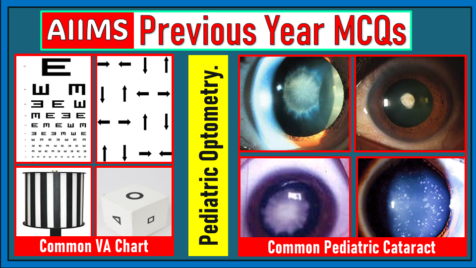 AIIMS Pediatric Optometry PYQs │AIIMS Optometry PYQs │Optometry Govt Job Preparation │AIIMS Previous Year MCQs
